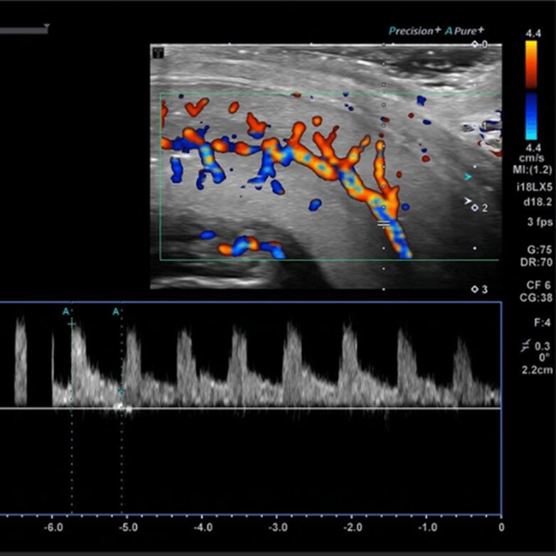 image of High-Resolution Ultrasound System and Digital X-Ray
