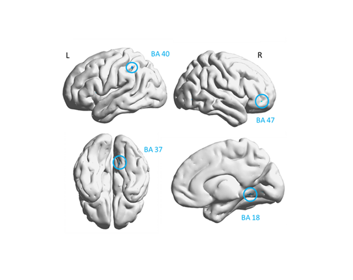 image of <br> Groundbreaking clinical trial shows remarkable results for kids with TBI